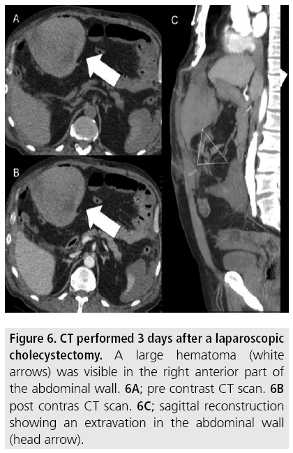 imaging-in-medicine-laparoscopic