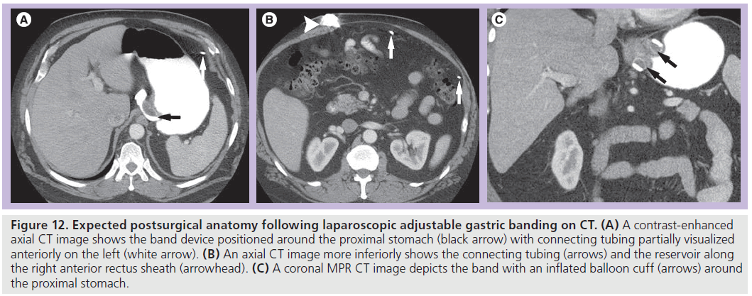 imaging-in-medicine-laparoscopic-adjustable