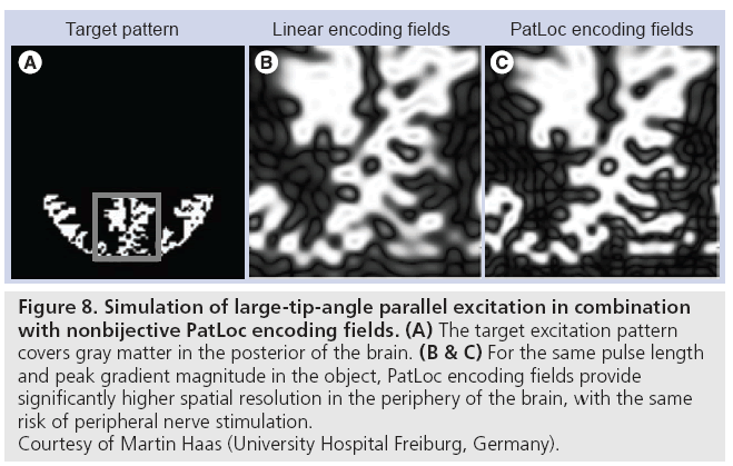 imaging-in-medicine-large-tip-angle