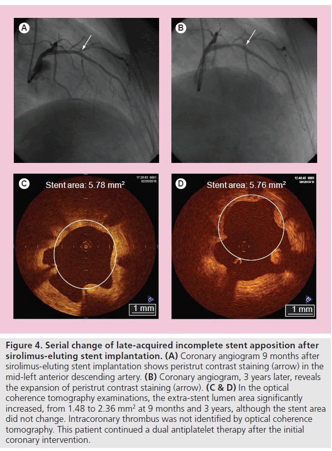 imaging-in-medicine-late-acquired