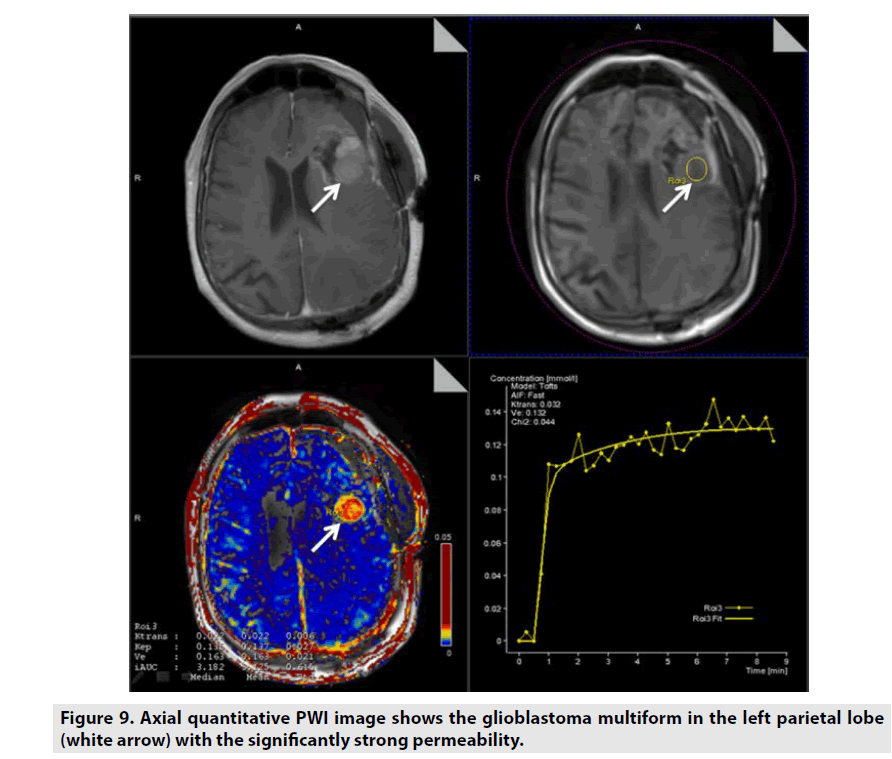 imaging-in-medicine-left-parietal