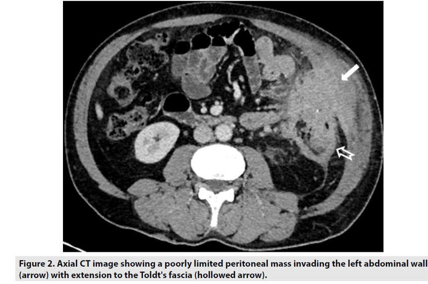 imaging-in-medicine-limited-peritoneal