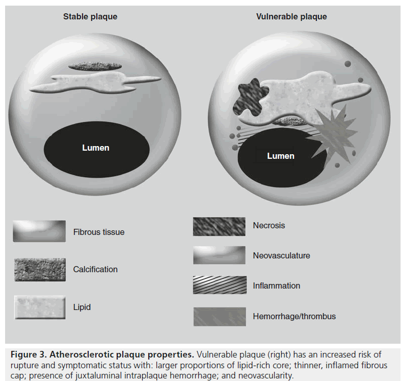 imaging-in-medicine-lipid-rich