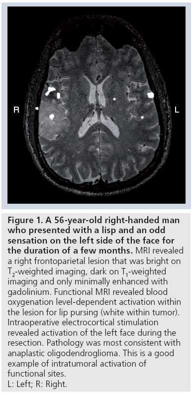 imaging-in-medicine-lisp