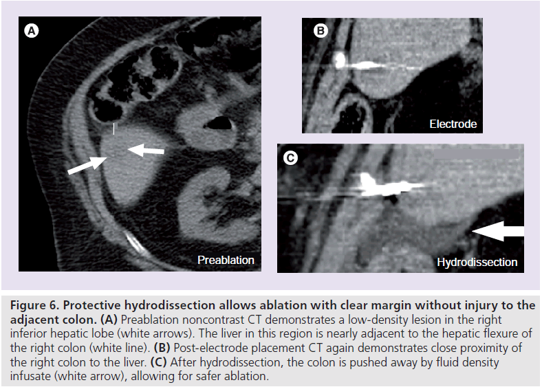 imaging-in-medicine-low-density