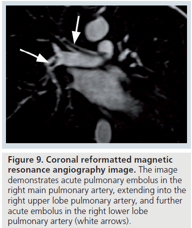 imaging-in-medicine-lower-lobe