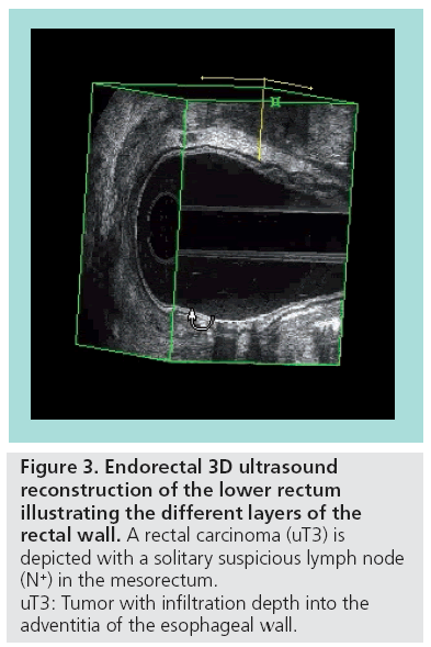 imaging-in-medicine-lower-rectum