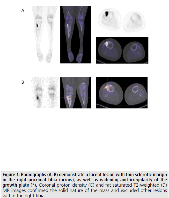 imaging-in-medicine-lucent-lesion