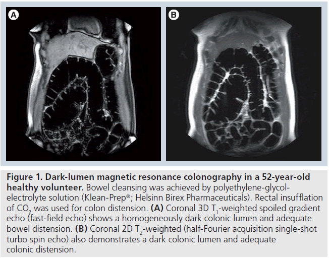 imaging-in-medicine-lumen-magnetic