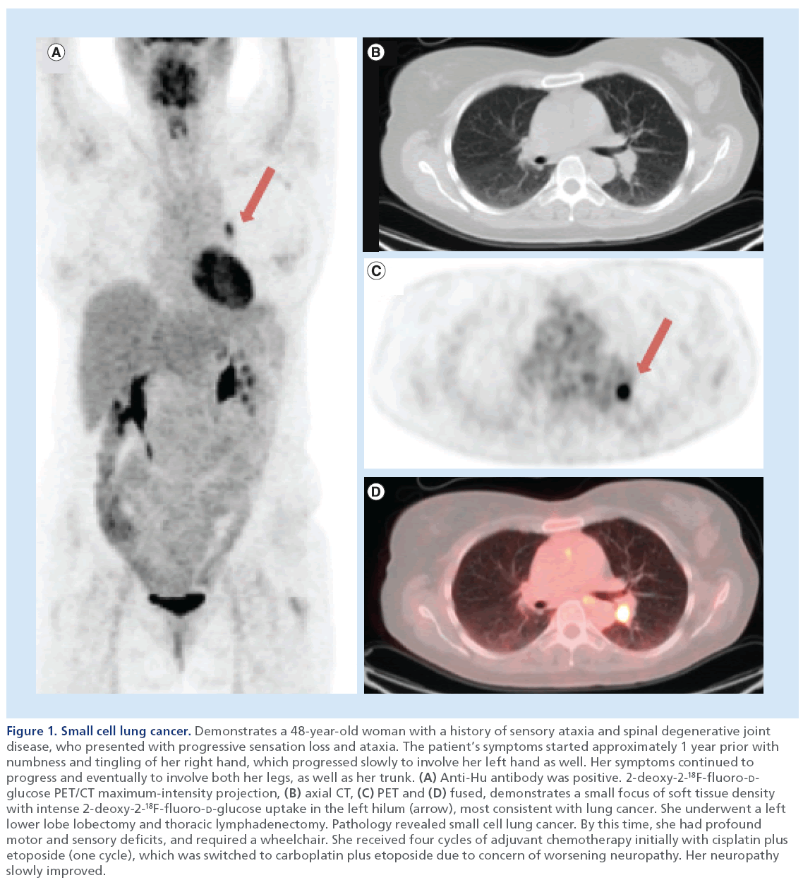 imaging-in-medicine-lung-cancer