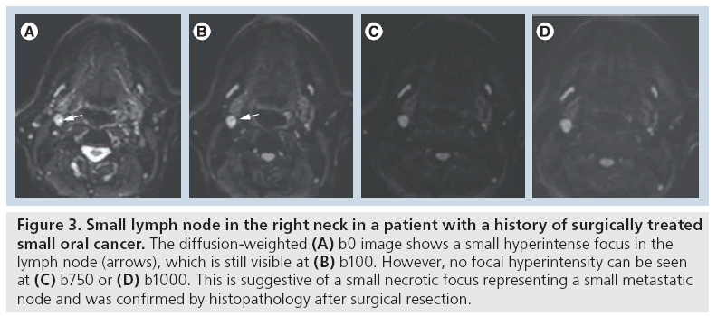 imaging-in-medicine-lymph-node