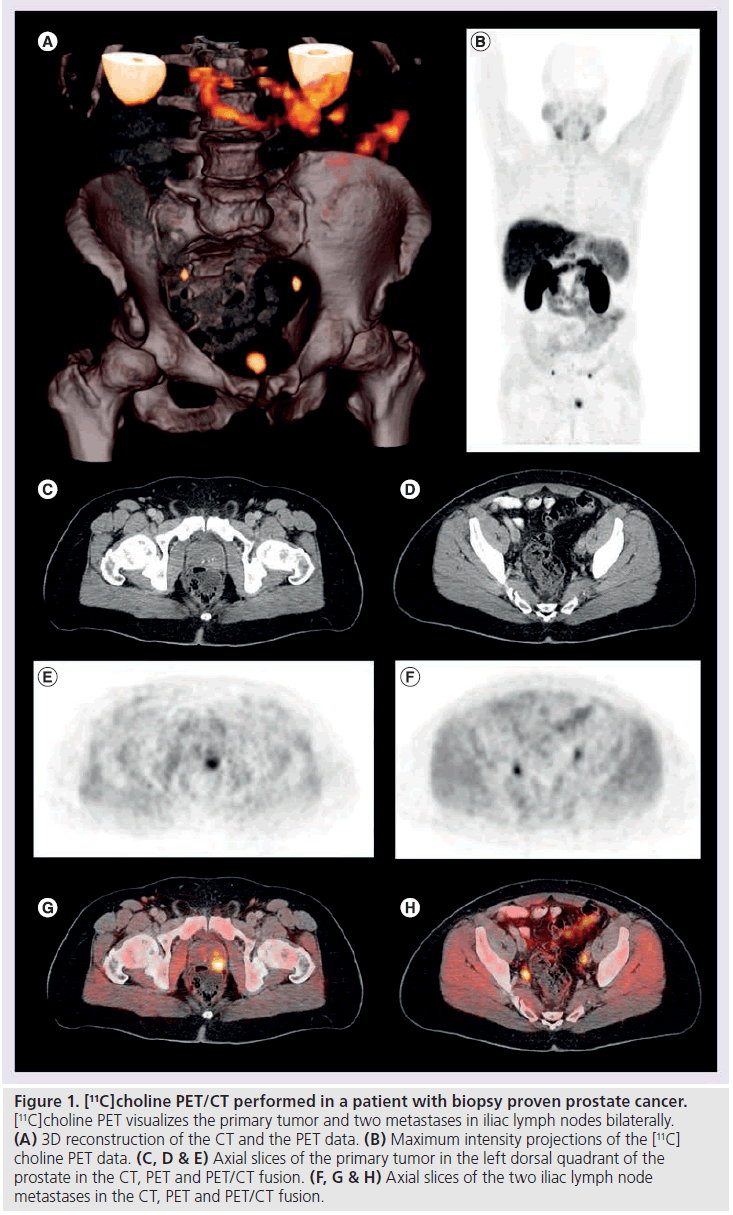 imaging-in-medicine-lymph-nodes