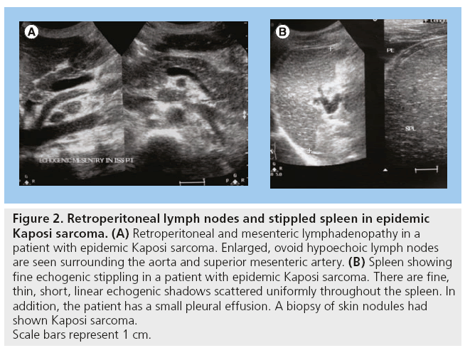 imaging-in-medicine-lymph-nodes