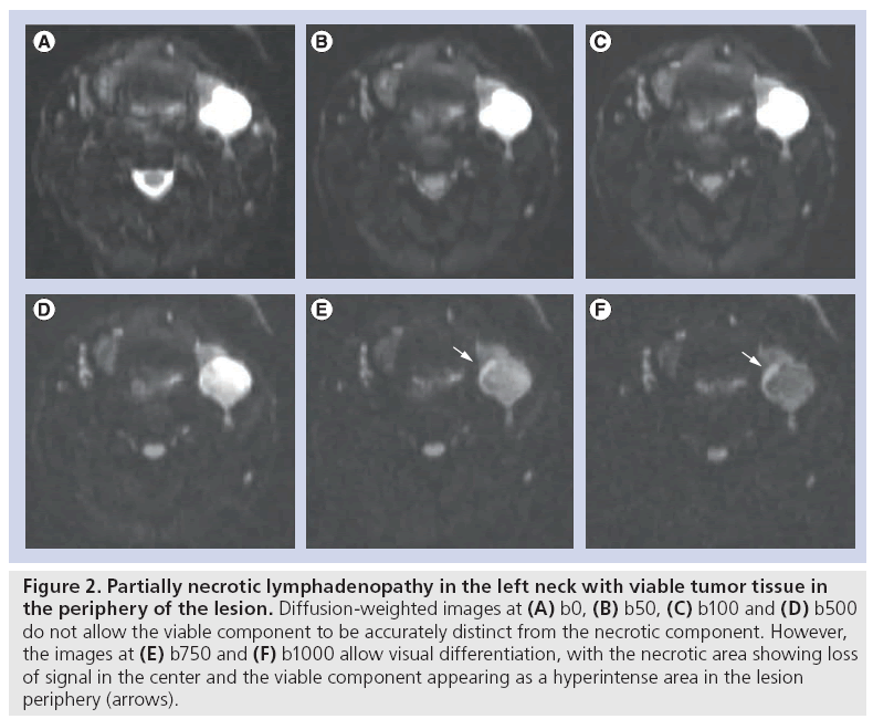 imaging-in-medicine-lymphadenopathy