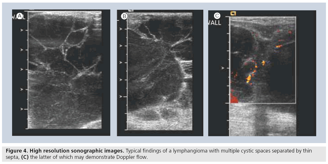 imaging-in-medicine-lymphangioma