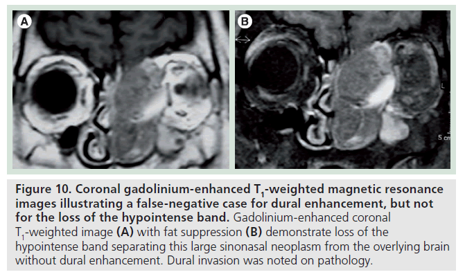 imaging-in-medicine-magnetic-resonance