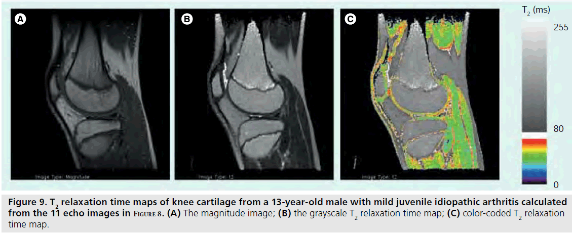 imaging-in-medicine-magnitude-image