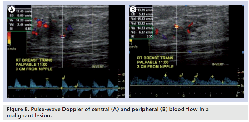 imaging-in-medicine-malignant-lesion	