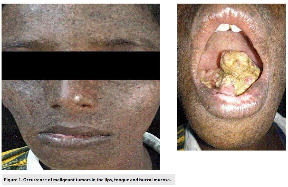 imaging-in-medicine-malignant-tumors