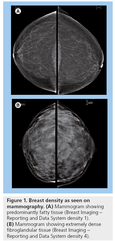 imaging-in-medicine-mammography