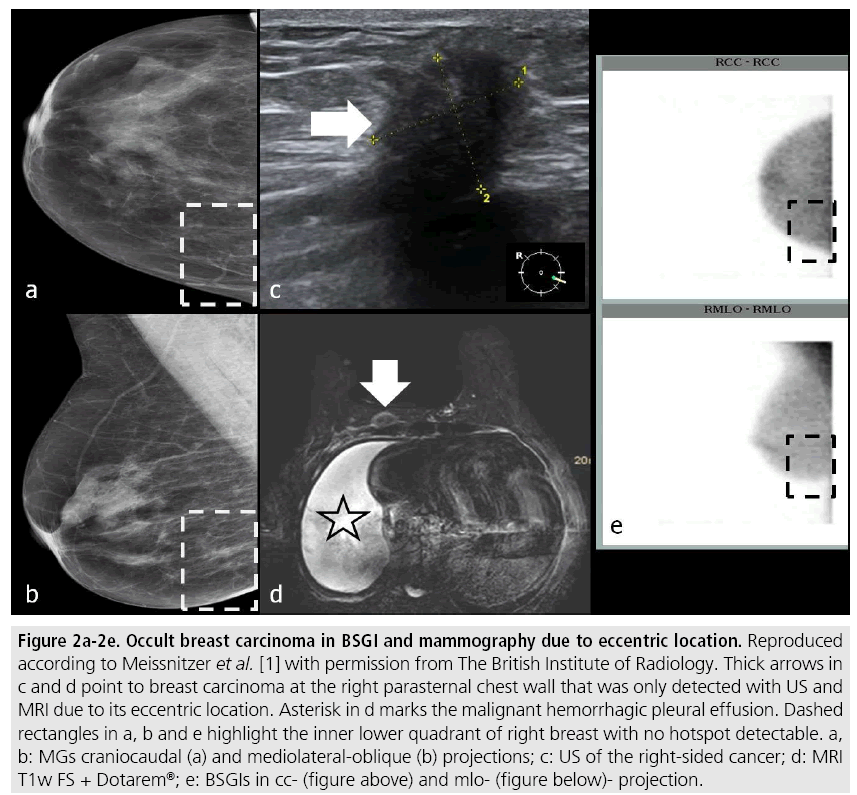 imaging-in-medicine-mammography