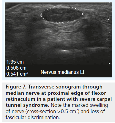 imaging-in-medicine-marked-swelling