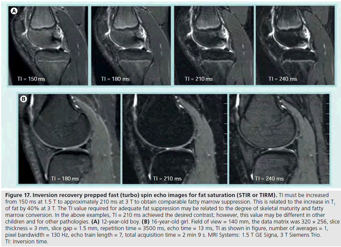 imaging-in-medicine-marrow-suppression