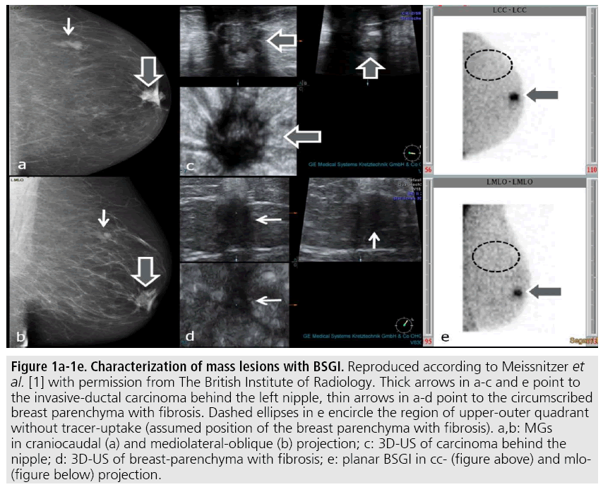 imaging-in-medicine-mass-lesions