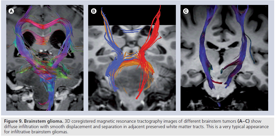 imaging-in-medicine--matter-tracts