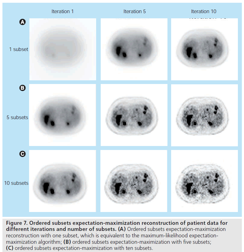 imaging-in-medicine-maximum-likelihood