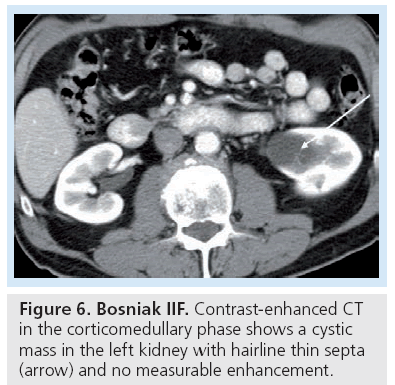 imaging-in-medicine-measurable-enhancement