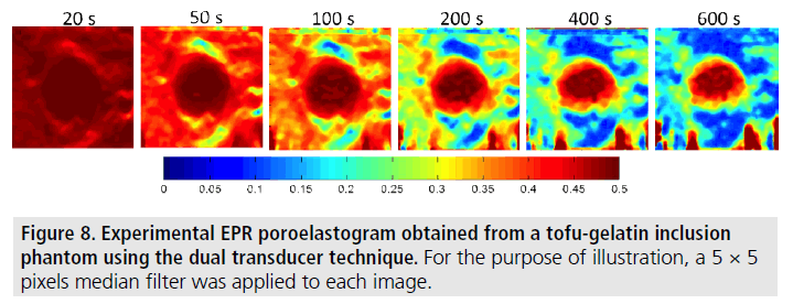 imaging-in-medicine-median-filter