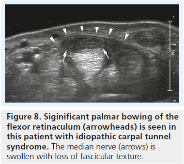 imaging-in-medicine-median-nerve