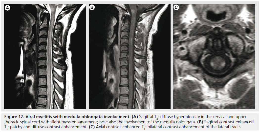 imaging-in-medicine-medulla-oblongata