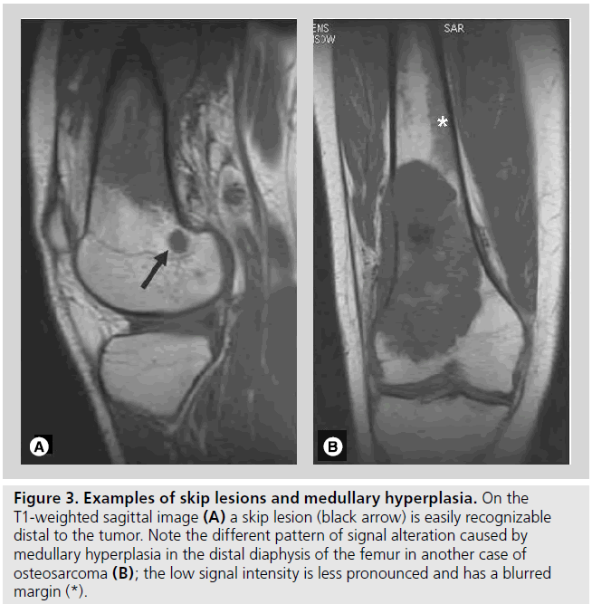 imaging-in-medicine-medullary-hyperplasia