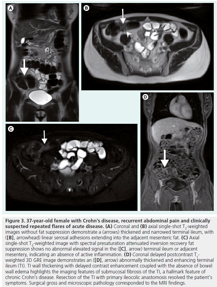 imaging-in-medicine-mesenteric-fat