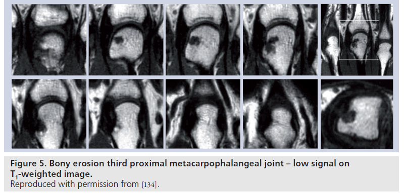imaging-in-medicine-metacarpophalangeal-joint
