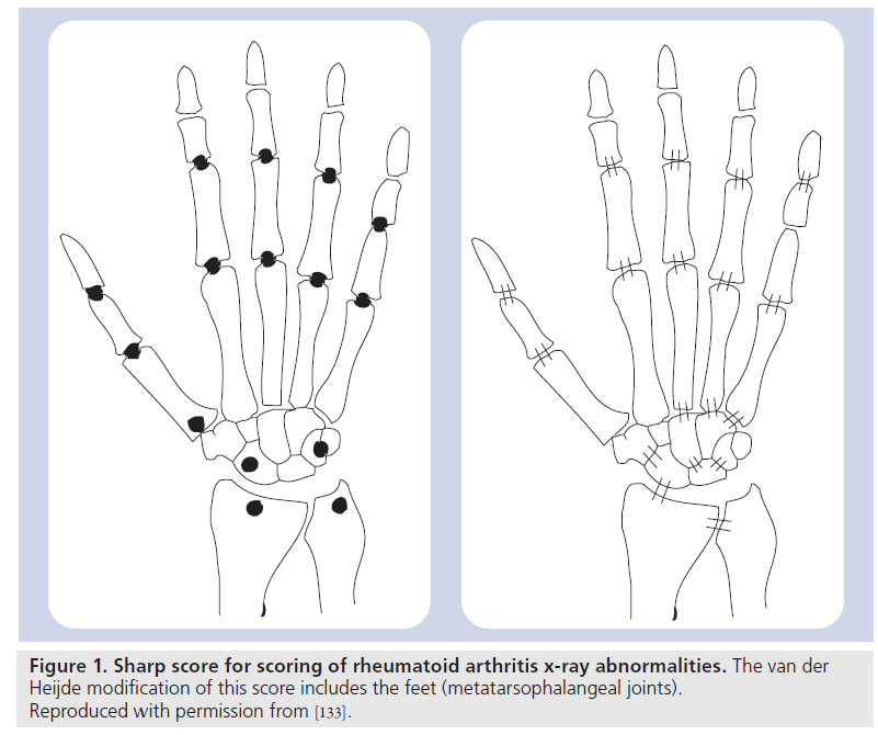 imaging-in-medicine-metatarsophalangeal-joints