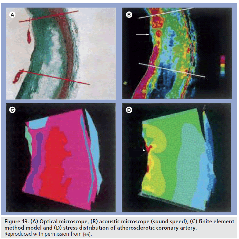 imaging-in-medicine-microscope-sound