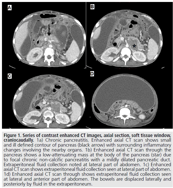 imaging-in-medicine-mildly-dilated