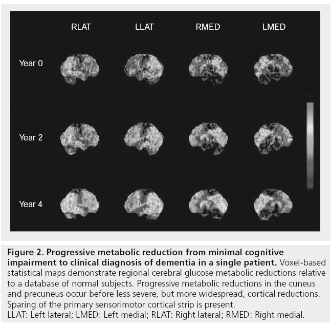 imaging-in-medicine-minimal-cognitive