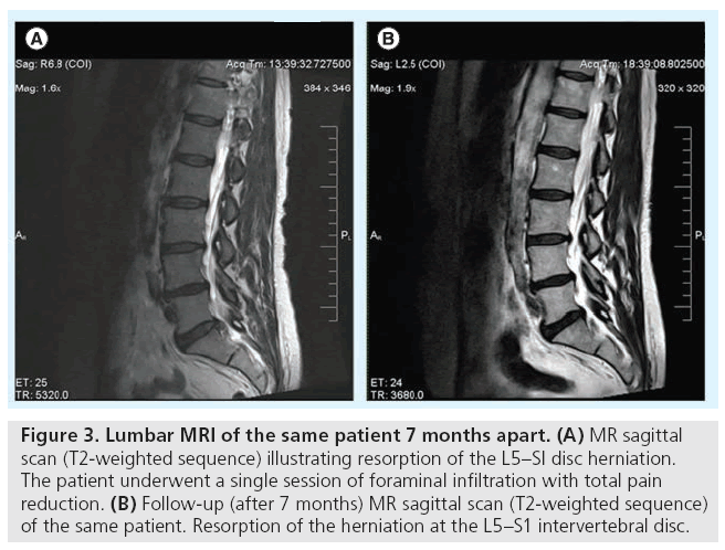 imaging-in-medicine-months-apart