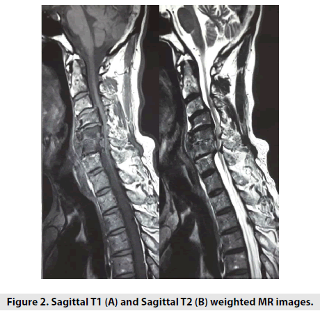imaging-in-medicine-mr-images