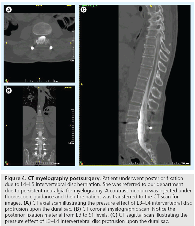 imaging-in-medicine-myelography