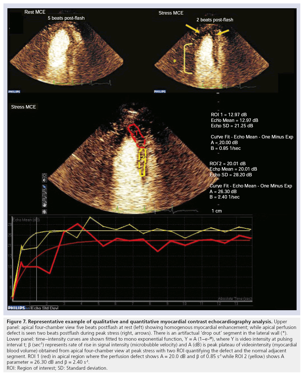 imaging-in-medicine-myocardial