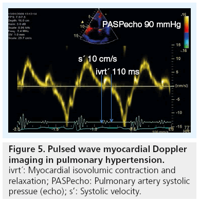 imaging-in-medicine-myocardial-Doppler