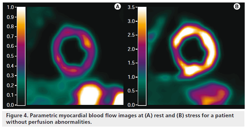 imaging-in-medicine-myocardial-blood