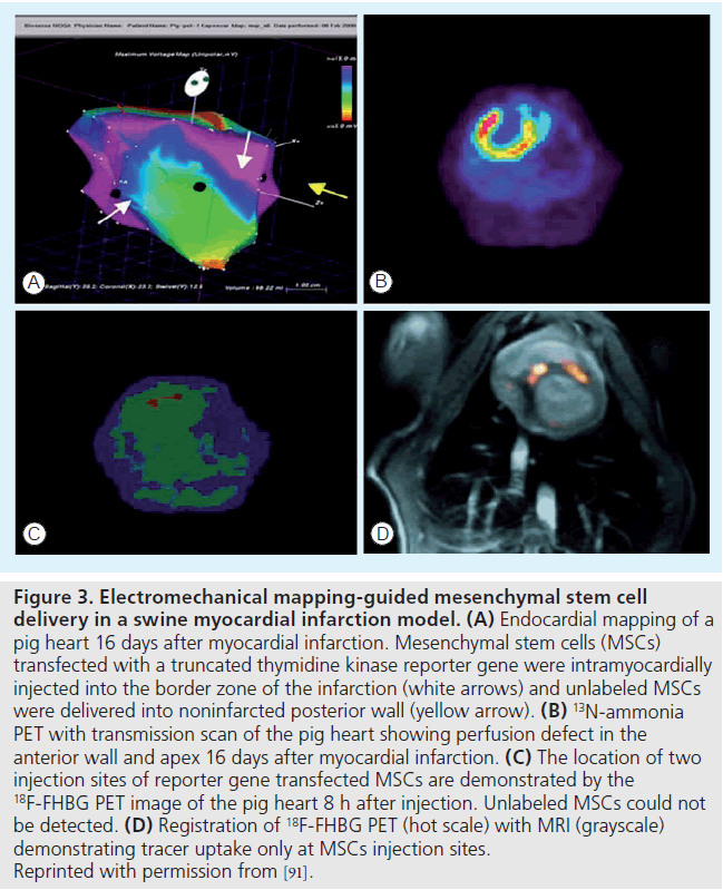 imaging-in-medicine-myocardial-infarction