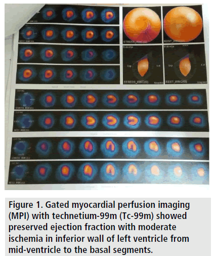 imaging-in-medicine-myocardial-perfusion