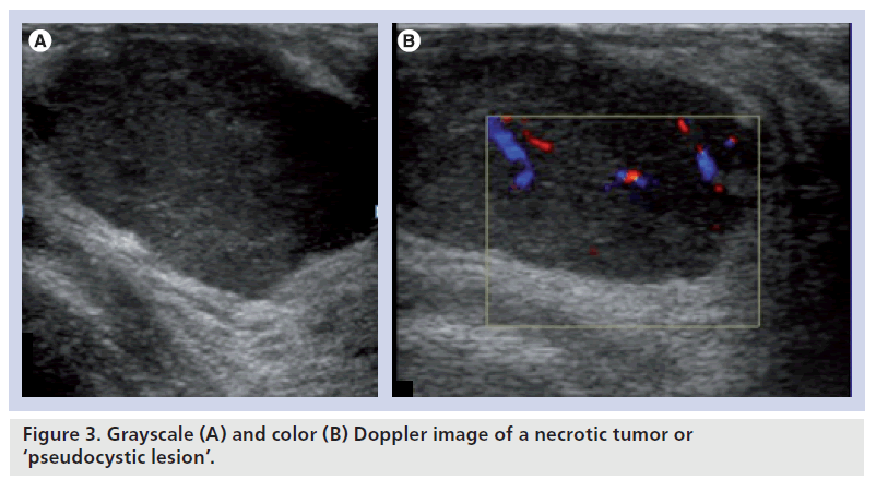 Doppler Ultrasound Color Chart